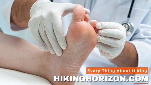 Athlete's Foot - What Are Common Foot Issues Experienced By Hikers
